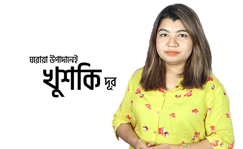 ঘরোয়া উপাদানেই খুশকি দূর করার উপায় জানেন কি?