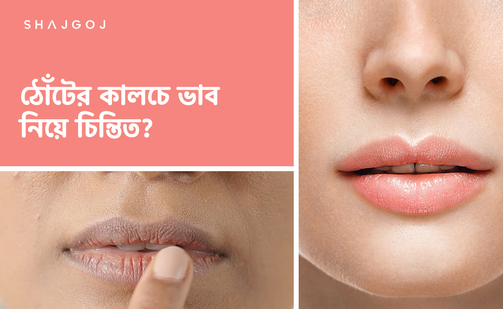 ঠোঁটের কালচে ভাব নিয়ে চিন্তিত?