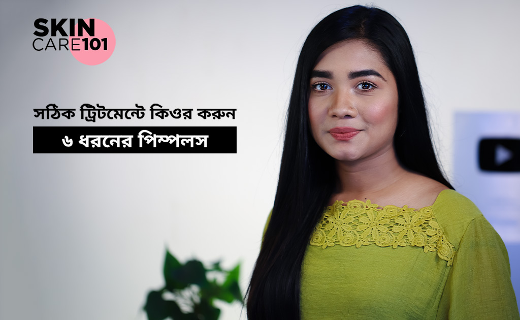 স্কিন কেয়ার ১০১| সঠিক ট্রিটমেন্টে কিওর করুন ৬ ধরনের পিম্পলস